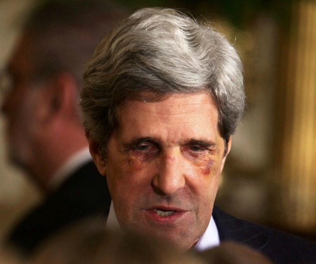 bruised-kerry.jpg